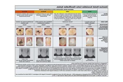 美国牙科协会龋齿分类系统.